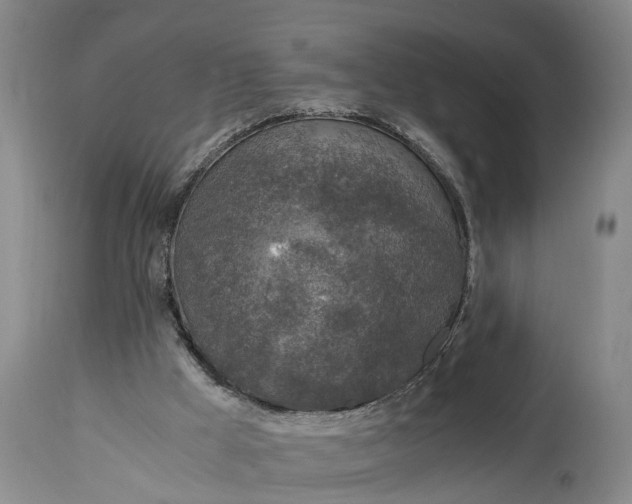 X0000115000009200911091409