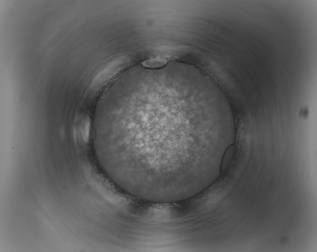 X0000115000076200911091408