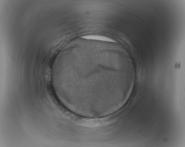 X0000115000029200911161547