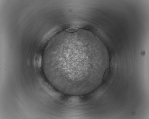 X0000115000076200911161546