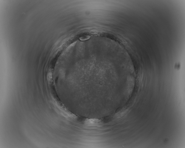 X0000115000137200911161545