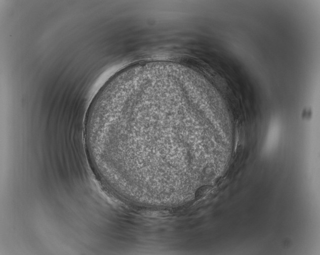 X0000115000147200911161545