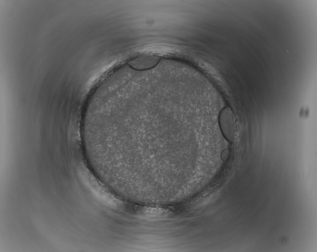 X0000115000399200911161541