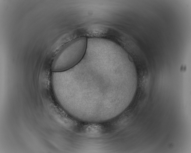 X0000115000599200911161538