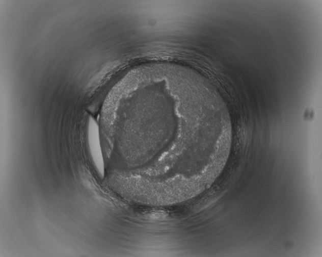 X0000115000600200911161538