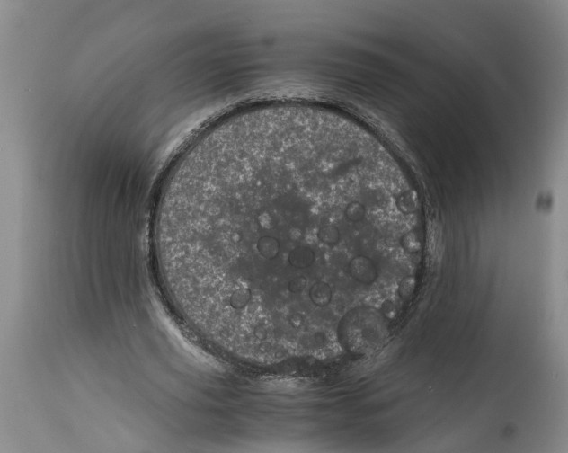 X0000115000629200911161538