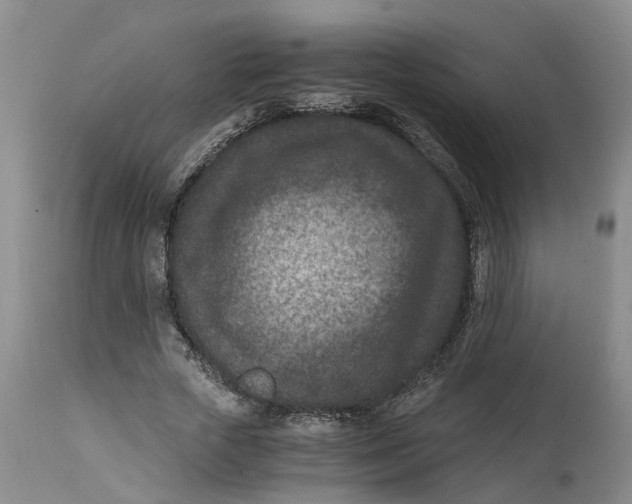 X0000115000729200911161536