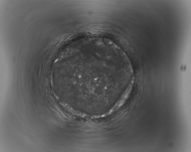 X0000115001009200911161532