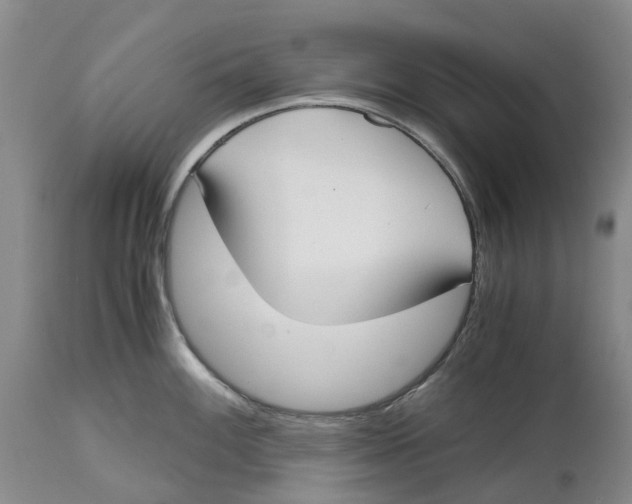 X0000115001100200911161531