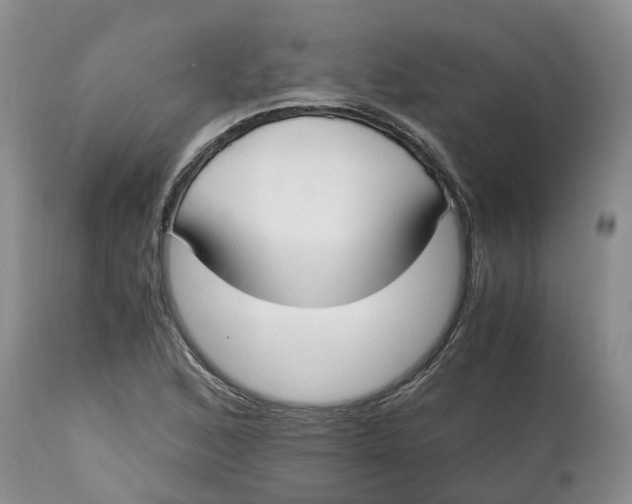 X0000115001168200911161530