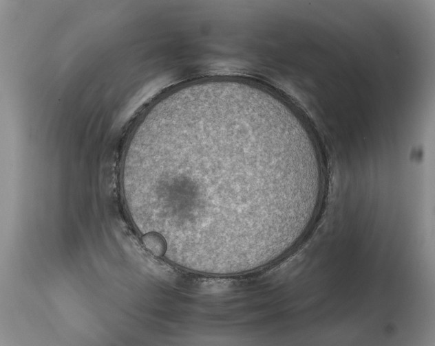 X0000115001211200911161529