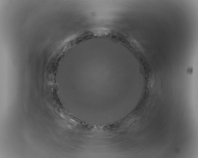 X0000115001445200911161526