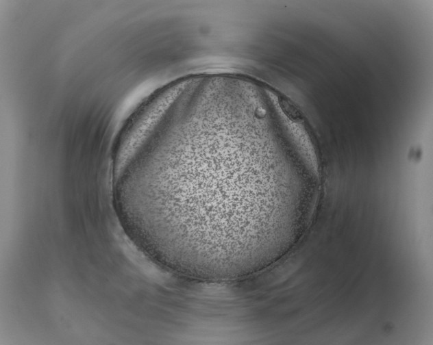 X0000115001472200911161525