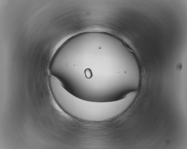 X0000115001476200911161525