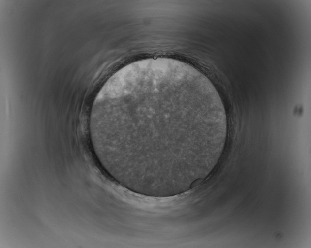 X0000115000035200911231215