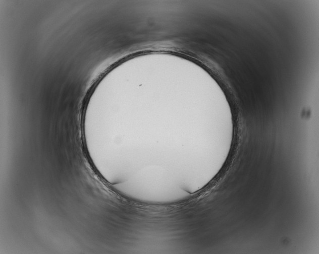 X0000115001176200911231158