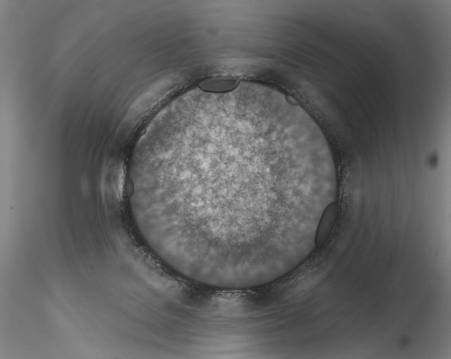 X0000115000076200912071150