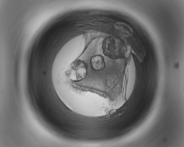 X0000115000143200912071149