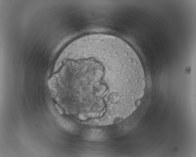 X0000115000159200912071148