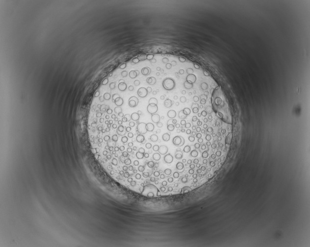 X0000115000171200912071149