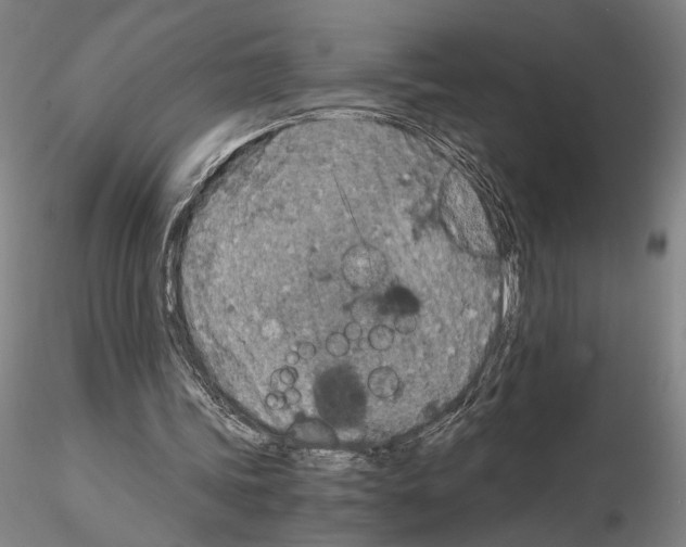 X0000115000339200912071145