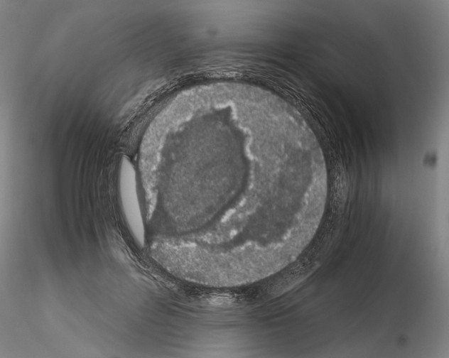 X0000115000600200912071142