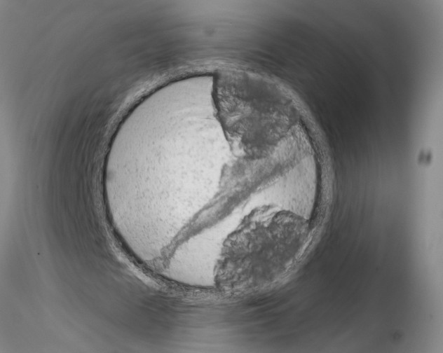 X0000115000625200912071140