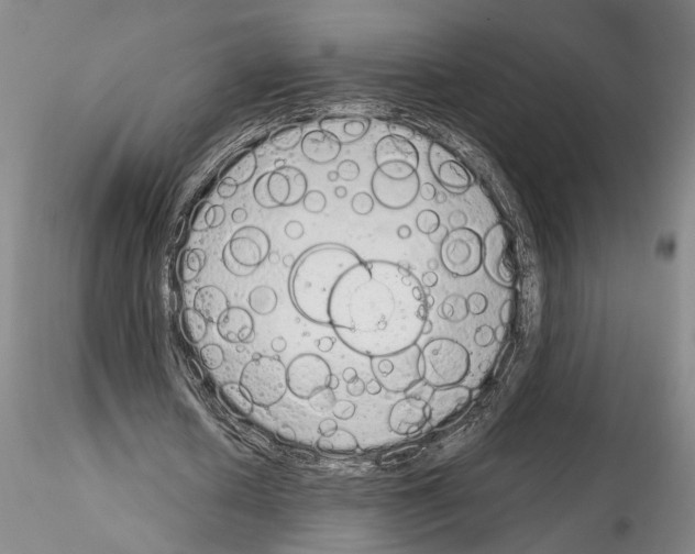 X0000115000626200912071140