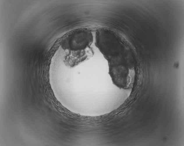 X0000115001016200912071135