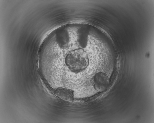 X0000115001117200912071133