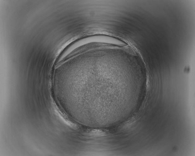 X0000115010390200911091425