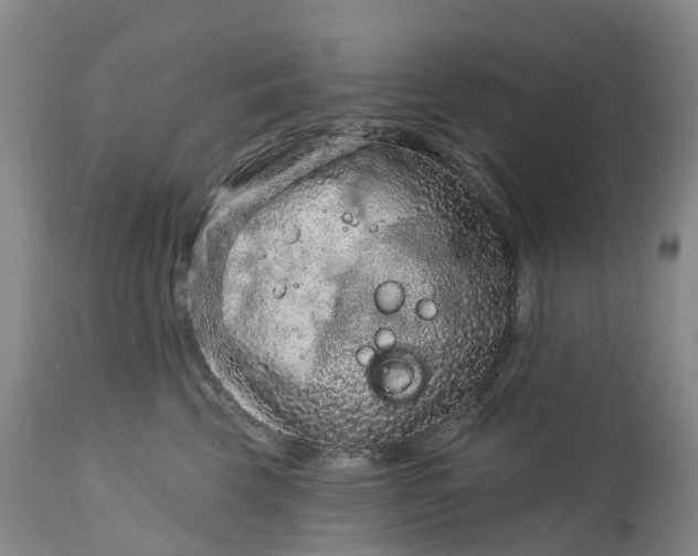 X0000115010569200911091423