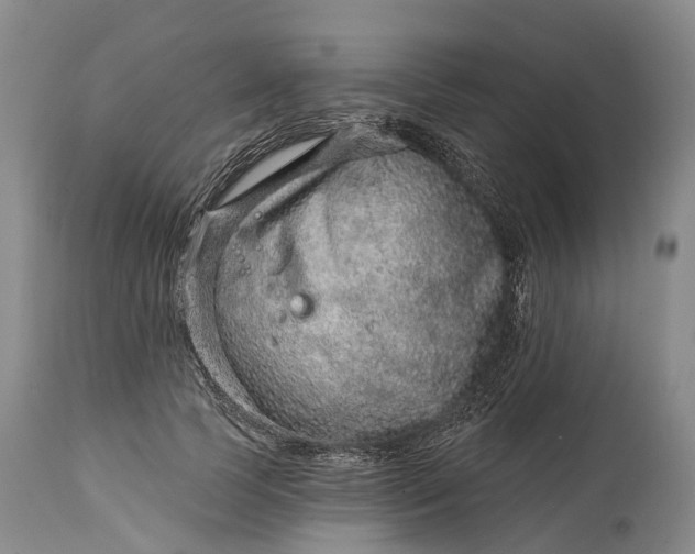 X0000115010745200911091420