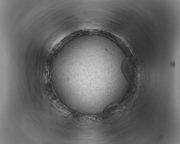 X0000115010871200911091418