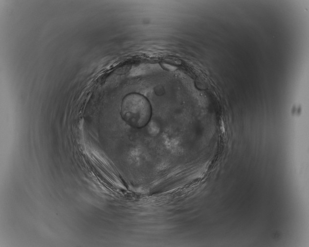 X0000115011009200911091416
