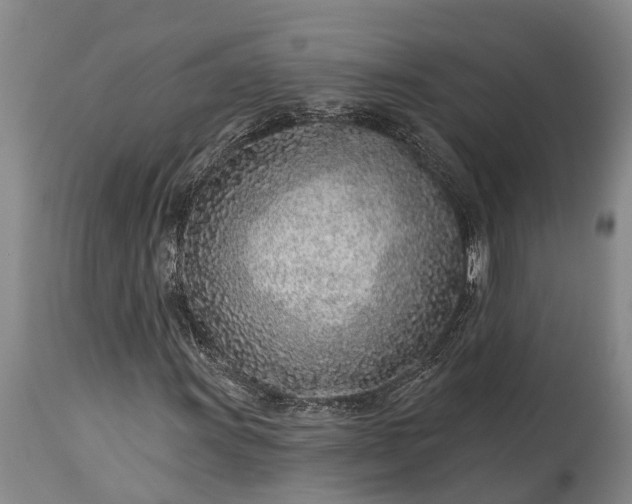 X0000115011011200911091416