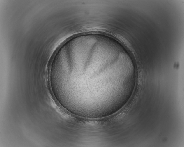 X0000115011031200911091416
