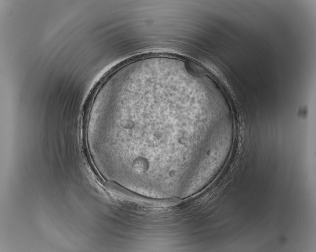X0000115011076200911091415