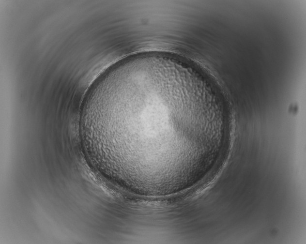 X0000115011121200911091415