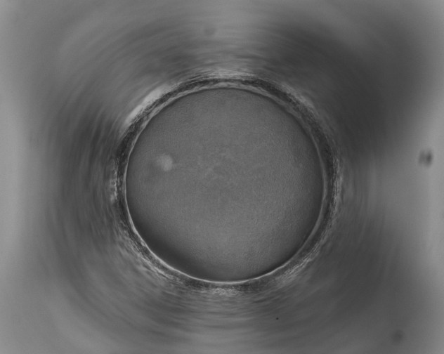 X0000115011306200911091412