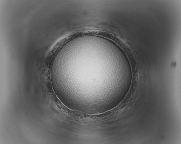 X0000115011351200911091411