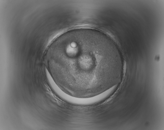 X0000115011405200911091410
