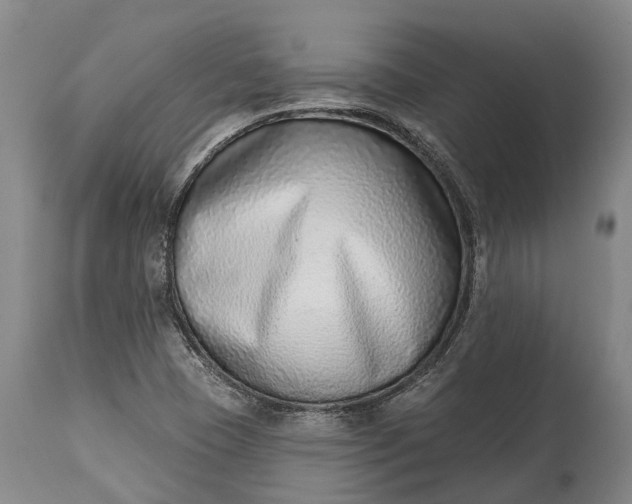 X0000115011409200911091410