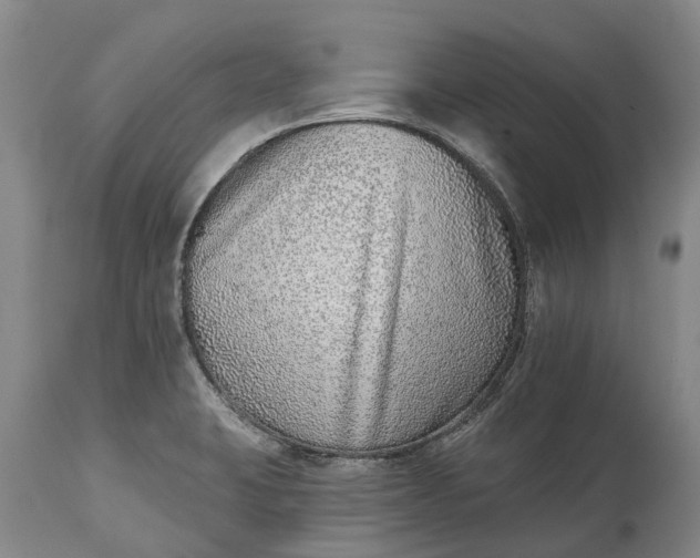 X0000115011423200911091411