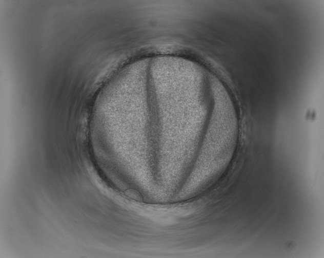X0000115010018200911161611