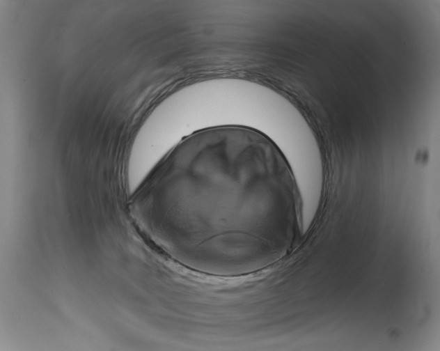 X0000115010035200911161611