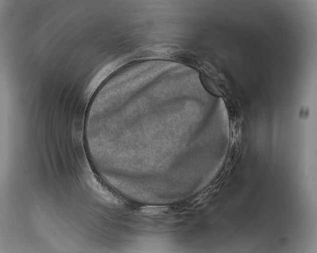 X0000115010051200911161610