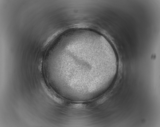 X0000115010153200911161609