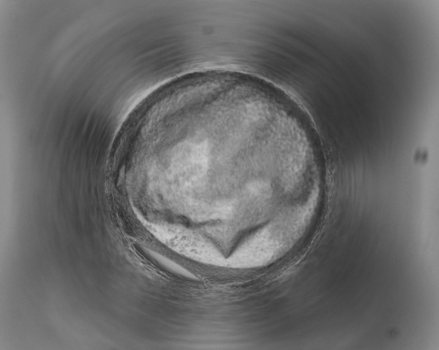 X0000115010879200911161558