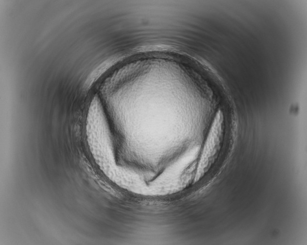 X0000115010921200911161557
